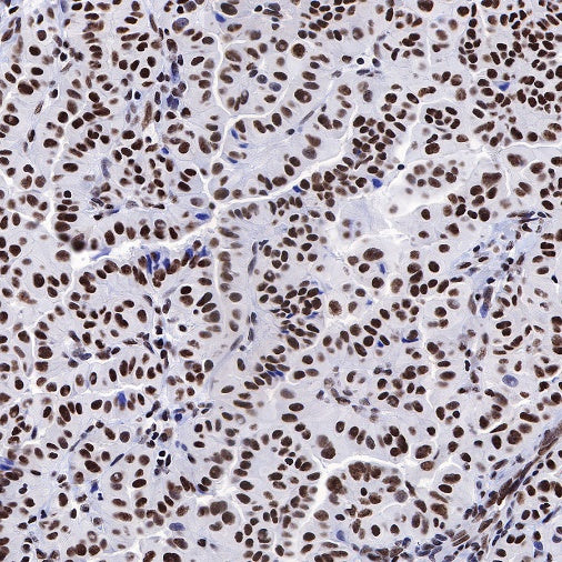 FUBP1 Recombinant Rabbit mAb (S-739-21)