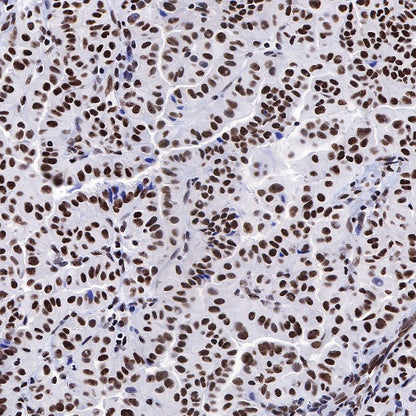 FUBP1 Recombinant Rabbit mAb (S-739-21)