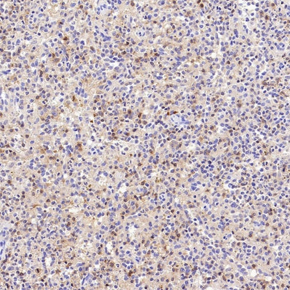 CD100/Semaphorin-4D Recombinant Rabbit mAb (S-3651-16)