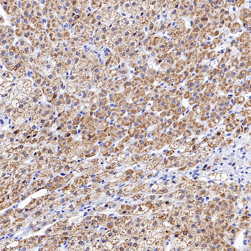 CYP11A1 Rabbit Polyclonal Antibody