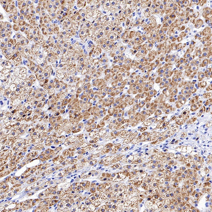 CYP11A1 Rabbit Polyclonal Antibody