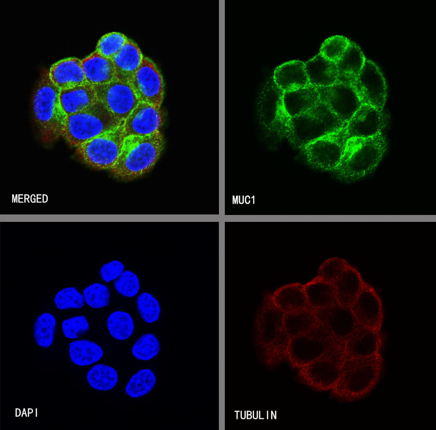 S-RMab® MUC1/EMA Recombinant Rabbit mAb (SDT-776-49)