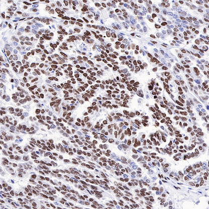 Dnmt1 Recombinant Rabbit mAb (S-R324)