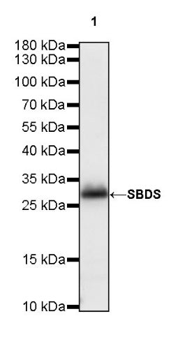 SBDS Recombinant Rabbit mAb (S-R344)