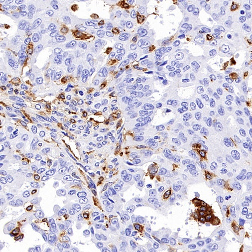 MARCKS Recombinant Rabbit mAb (S-3190-72)