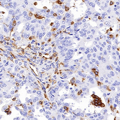 MARCKS Recombinant Rabbit mAb (S-3190-72)