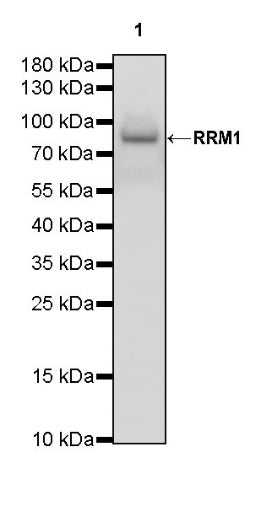 RRM1 Recombinant Rabbit mAb (S-587-21)