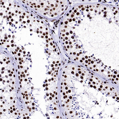 NRF1 Recombinant Rabbit mAb (S-2409-103)