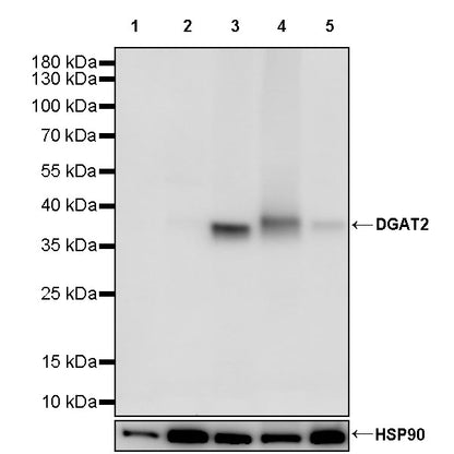 DGAT2 Recombinant Rabbit mAb (S-3871-31)