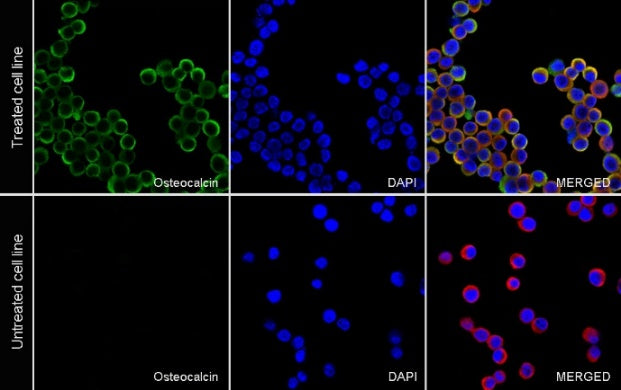 Osteocalcin Recombinant Rabbit mAb ,PBS Only (SDT-2311-37)