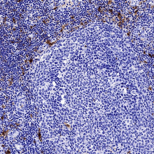Factor XIIIa Recombinant Rabbit mAb (SDT-644-7)