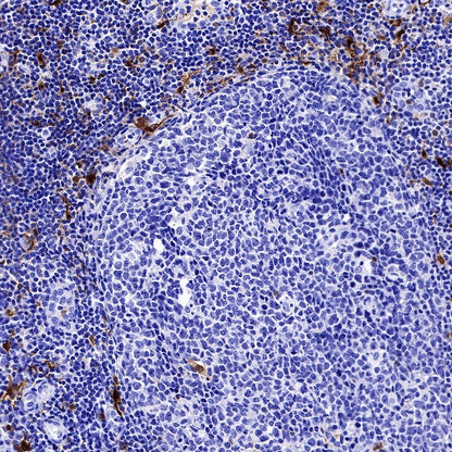 Factor XIIIa Recombinant Rabbit mAb (SDT-644-7)