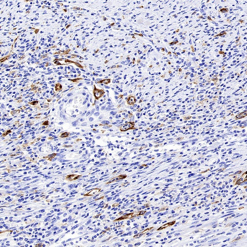Mannose Receptor Recombinant Rabbit mAb (SDT-2206-52)