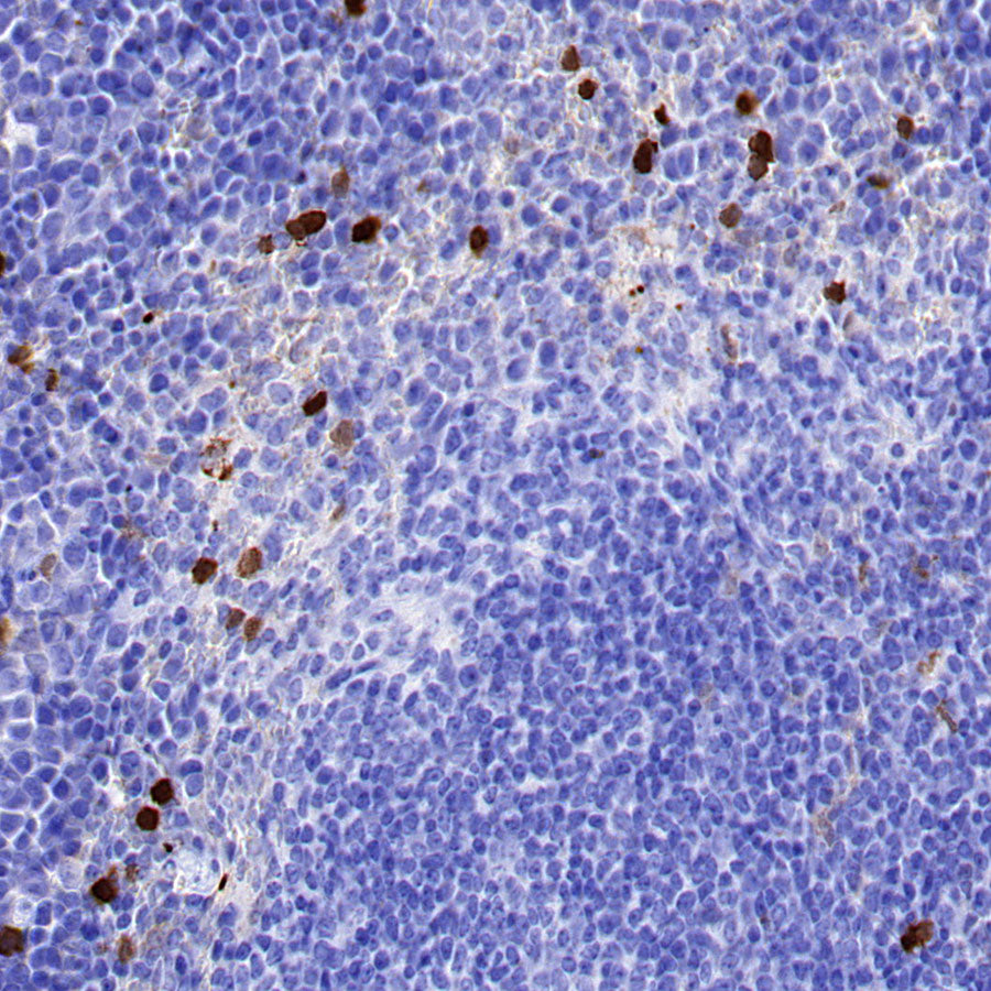 AOAH Recombinant Rabbit mAb (S-3713-10)
