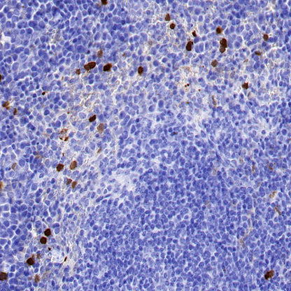 AOAH Recombinant Rabbit mAb (S-3713-10)