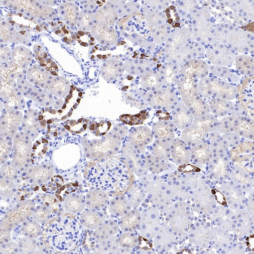 CA2 Rabbit Polyclonal Antibody