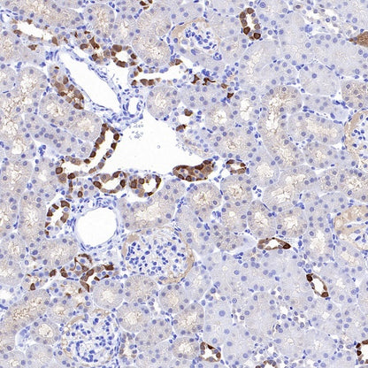 CA2 Rabbit Polyclonal Antibody