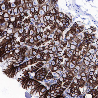 p120 Catenin Recombinant Rabbit mAb (SDT-350-75)