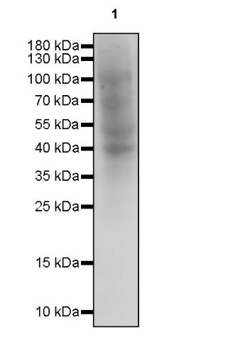 Man6P Recombinant Rabbit mAb (S-2745)