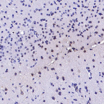 Phospho-α-Synuclein (Ser129) Recombinant Rabbit mAb (SDT-3397)