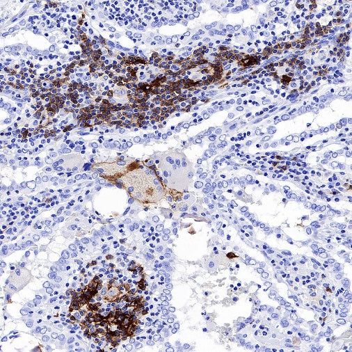CCR7 Recombinant Rabbit mAb (S-999-29)
