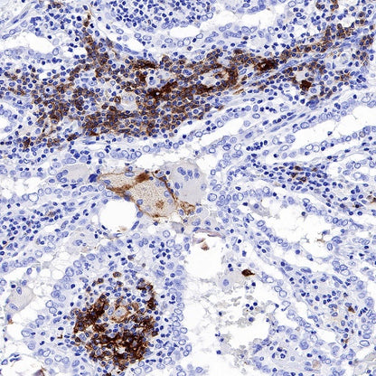 CCR7 Recombinant Rabbit mAb (S-999-29)