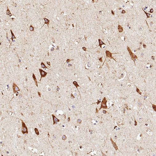 SPARCL1 Recombinant Rabbit mAb (S-3326-27)