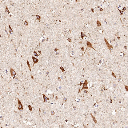 SPARCL1 Recombinant Rabbit mAb (S-3326-27)