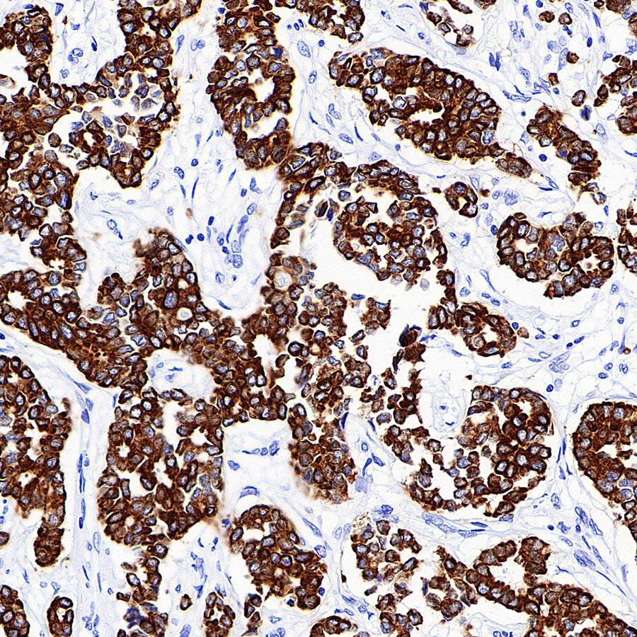 Cytokeratin 7 Recombinant Rabbit mAb (S-5954)