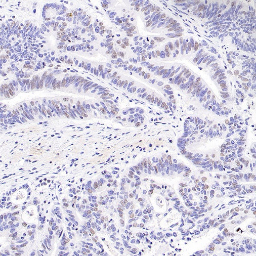 Histone H3 (acetyl K4) Recombinant Rabbit mAb (S-848-137)