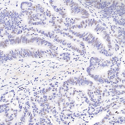 Histone H3 (acetyl K4) Recombinant Rabbit mAb (S-848-137)