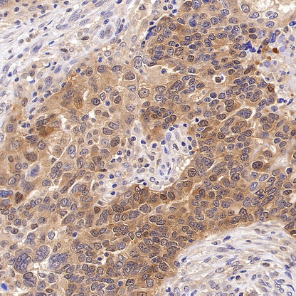 Tug Recombinant Rabbit mAb (S-4377-21)