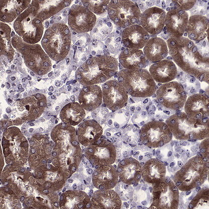 DOCK11 Recombinant Rabbit mAb (S-4420-57)