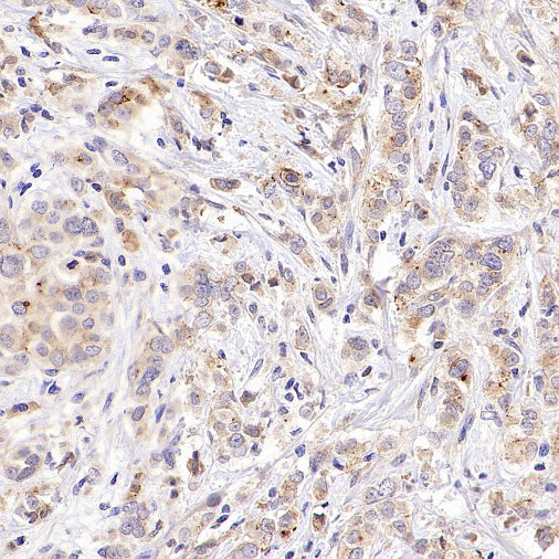 SFRP1 Recombinant Rabbit mAb (S-3071-18)