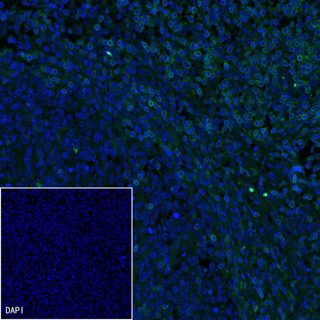 CD3 epsilon Recombinant Rabbit mAb (SDT-241-49)