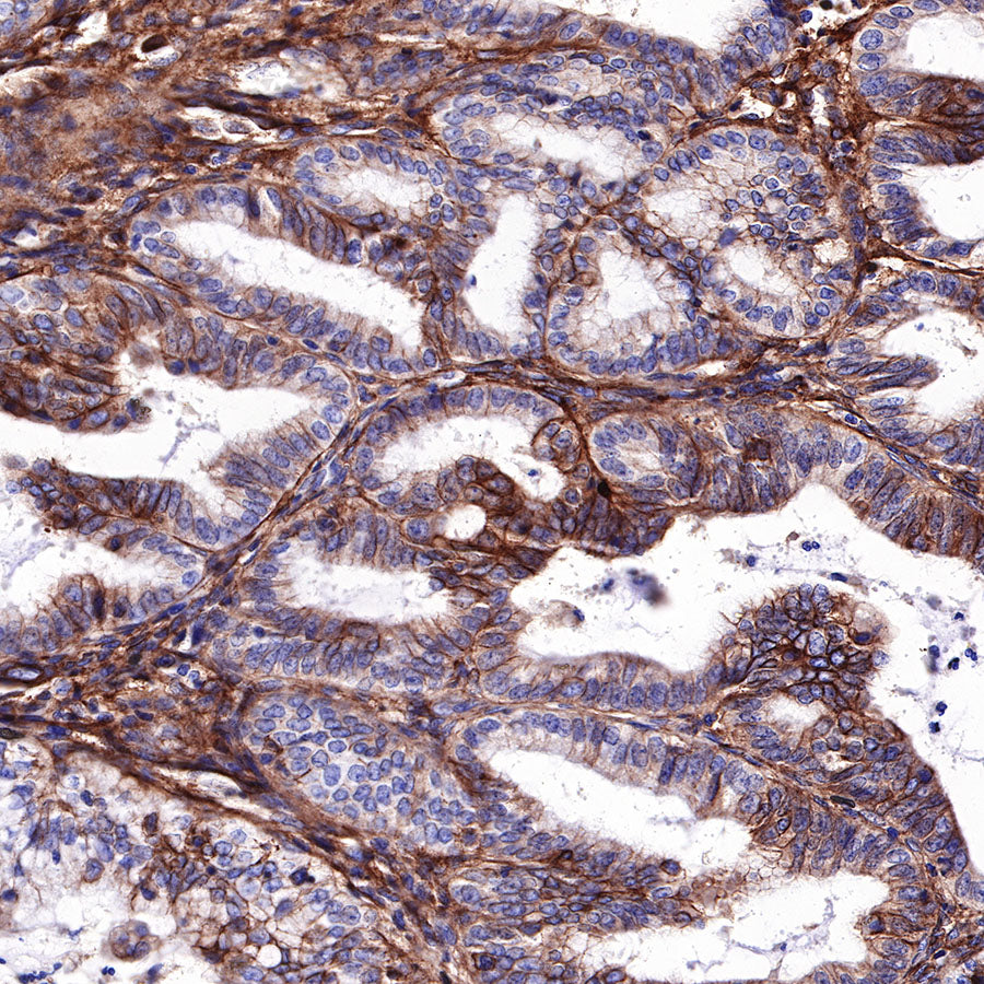 S-RMab®B7-H3/CD276 Recombinant Rabbit mAb (SDT-R158)