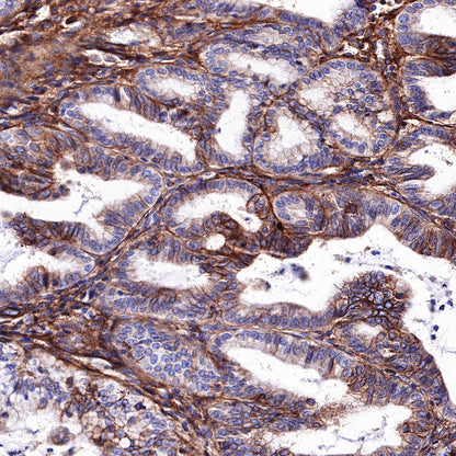 S-RMab®B7-H3/CD276 Recombinant Rabbit mAb (SDT-R158)