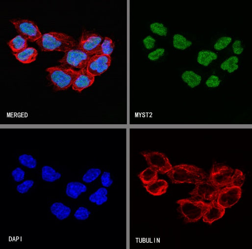 MYST2 Recombinant Rabbit mAb (S-3730-123)