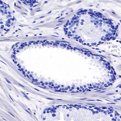 PEG10 Recombinant Rabbit mAb (SDT-442-60)
