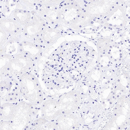 NFAT2 Recombinant Mouse mAb (S-4705)