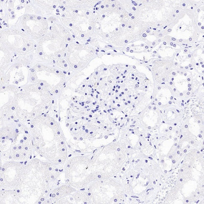 NFAT2 Recombinant Mouse mAb (S-4705)