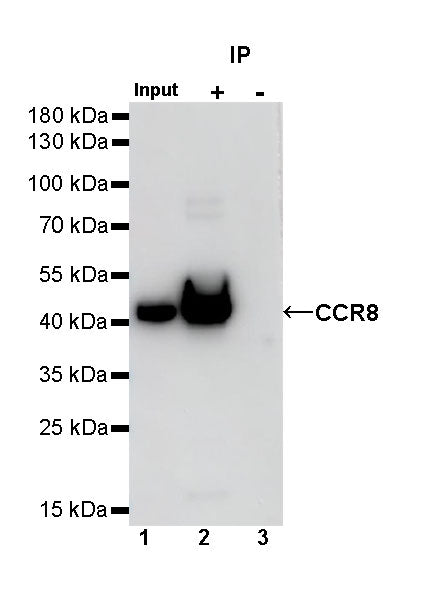 CCR8 Recombinant Rabbit mAb (S-1414-148)