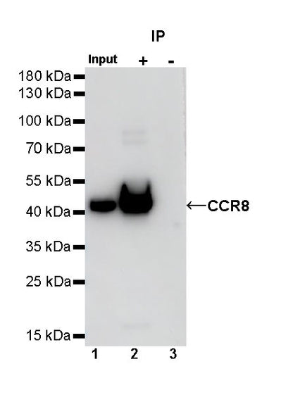 CCR8 Recombinant Rabbit mAb (S-1414-148)