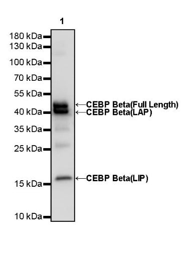 CEBP Beta (C-terminal) Recombinant Rabbit mAb (S-773-48)