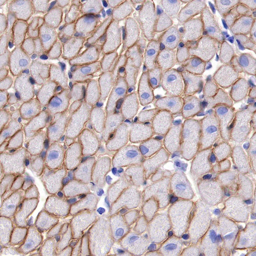 Dystrophin Recombinant Rabbit mAb (S-090-327)