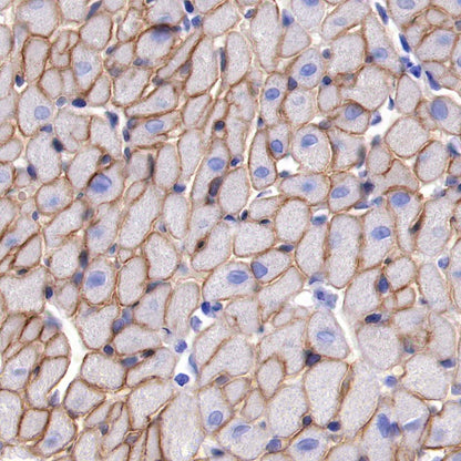 Dystrophin Recombinant Rabbit mAb (S-090-327)