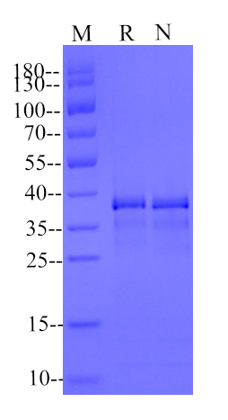 Cathepsin S His Tag Protein, Human