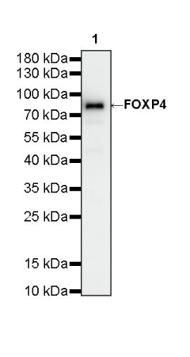 FOXP4 Recombinant Rabbit mAb (S-6198)