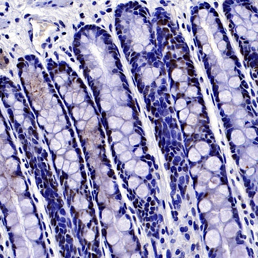Phospho-NAK/TBK1 (Ser172) Recombinant Rabbit mAb (S-3182)