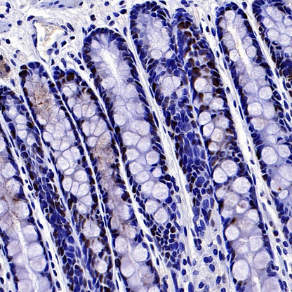 Phospho-NAK/TBK1 (Ser172) Recombinant Rabbit mAb (S-3182)